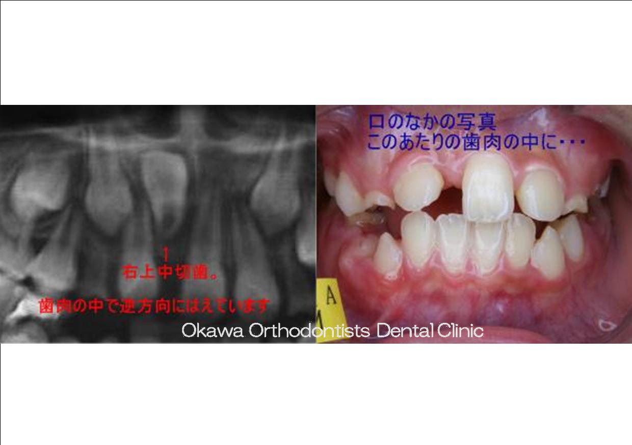 5. がんばってよかったね！の Before 画像