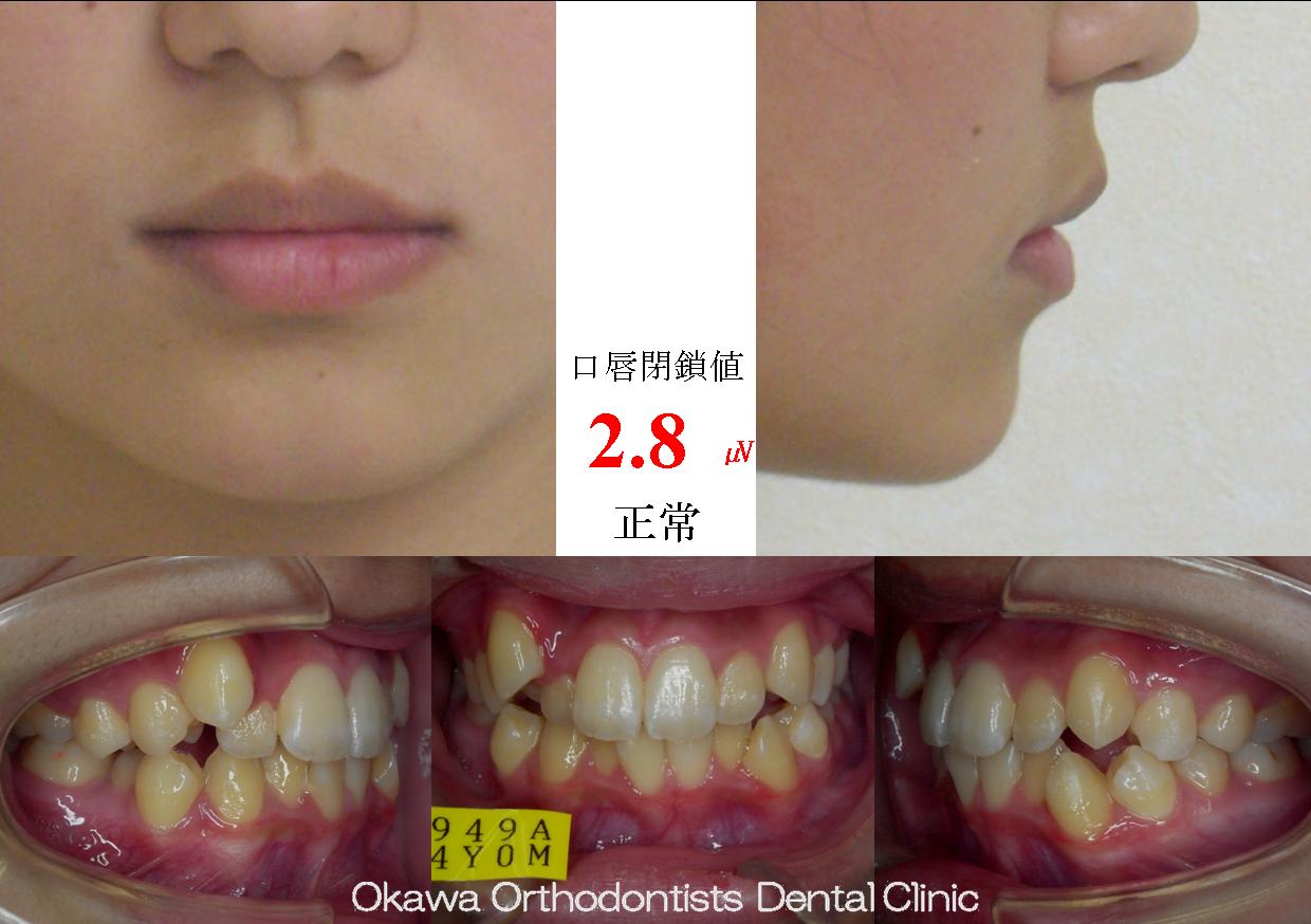 45. 遠くからの通院の Before 画像