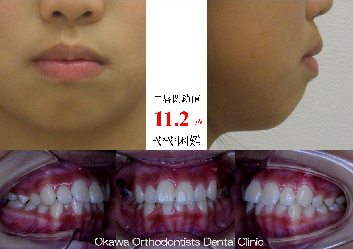 185. 良好な結果の Before 画像