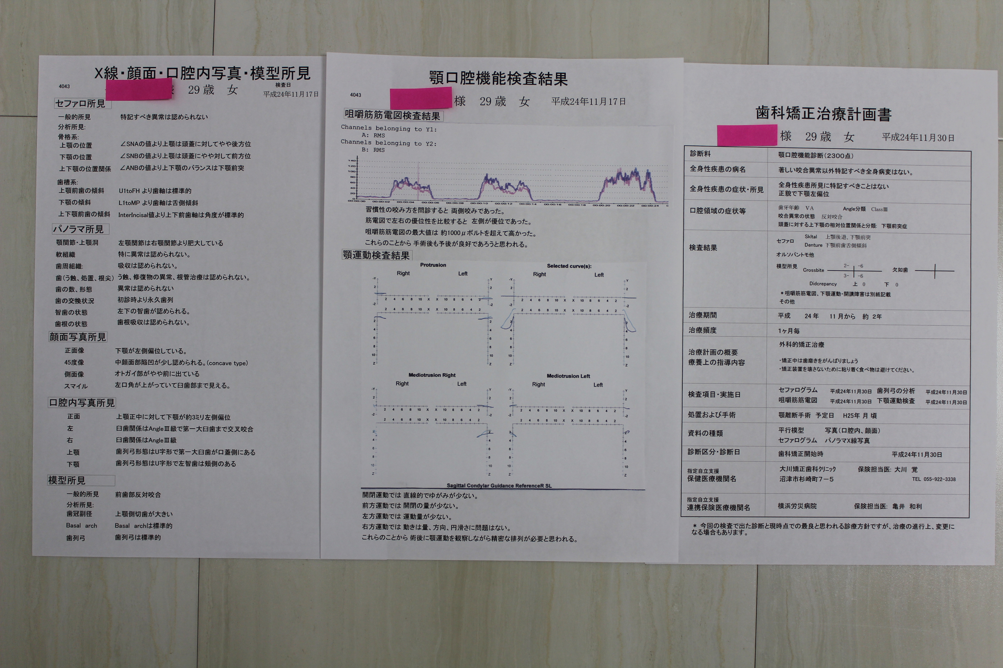 顎変形症診断 大川矯正歯科クリニック 静岡県沼津市の矯正歯科 ホワイトニング